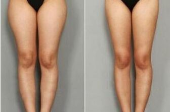 南寧皮膚外科醫(yī)院排名哪家醫(yī)院皮膚外科好？