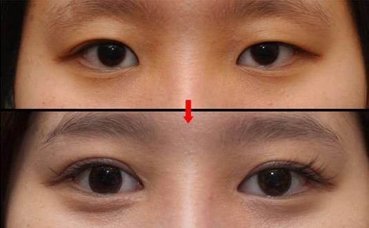 2023云南屁股大吸脂正規(guī)專(zhuān)家評(píng)價(jià)前十強(qiáng)(楊乂、陳麗、謝菊紅這幾個(gè)醫(yī)生真不錯(cuò)！)