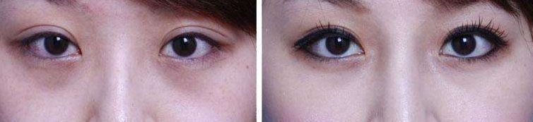 鄭州整容醫(yī)院排名，鄭州做整容找哪家醫(yī)院好