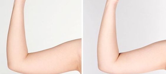 宿州雙眼皮醫(yī)院哪家好？揭秘宿州地區(qū)專業(yè)雙眼皮整形醫(yī)院