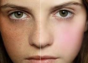 宿州疤痕修復(fù)醫(yī)院哪家好？幫你選擇最適合的宿州疤痕治療?？漆t(yī)院