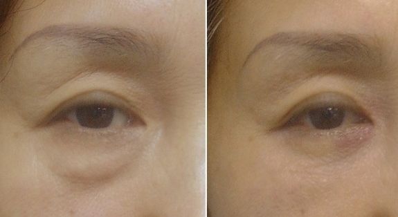 解放軍總裝備部后勤部亞運(yùn)村門診部怎么樣？解放軍總裝備部后勤部亞運(yùn)村門診部簡(jiǎn)介|醫(yī)生團(tuán)隊(duì)|口碑評(píng)價(jià)！