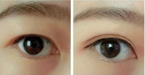 合肥熱瑪吉哪家醫(yī)院好？?jī)?yōu)質(zhì)服務(wù)與專(zhuān)業(yè)技術(shù)讓您擁有完美體驗(yàn)。