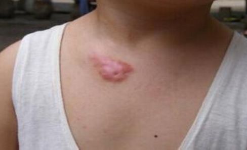 鄭州做鼻子修復(fù)哪家好？權(quán)威排名榜單解析！