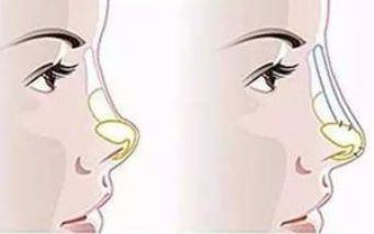 河南中醫(yī)藥大學第一附屬醫(yī)院整形科技術與醫(yī)生表現(xiàn)口碑如何？