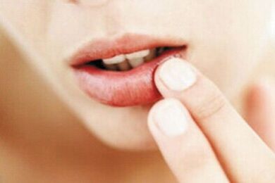 2023濟(jì)南激光祛眼睛細(xì)紋醫(yī)生前10強(qiáng)排名榜(李文德、王曉林、趙峰值得信賴和選擇！)