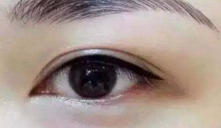 青海大學(xué)附屬醫(yī)院醫(yī)療整形美容科是否專(zhuān)業(yè)可靠？?jī)?yōu)勢(shì)有哪些？