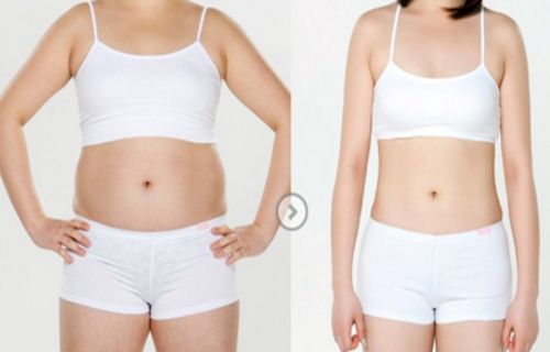 合肥哪家醫(yī)院去痘坑好？選擇最適合您皮膚需求的醫(yī)院