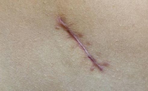 重慶整形技術(shù)，哪家醫(yī)院好？探尋重慶整形技術(shù)最佳醫(yī)院有哪些