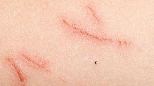 開封哪家醫(yī)院的減肥治療效果最好？