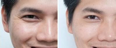 南京哪家整形醫(yī)院隆鼻效果最好？