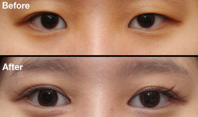 昆明刀疤修復(fù)哪家醫(yī)院好？挑選昆明專業(yè)刀疤修復(fù)醫(yī)院的技巧與要點(diǎn)