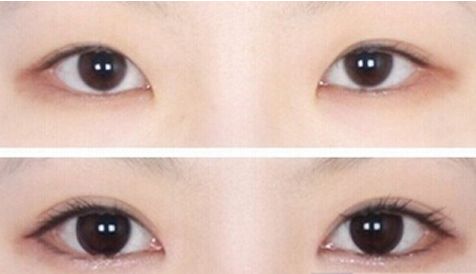 濟(jì)南哪家醫(yī)院的豐胸手術(shù)效果最好？