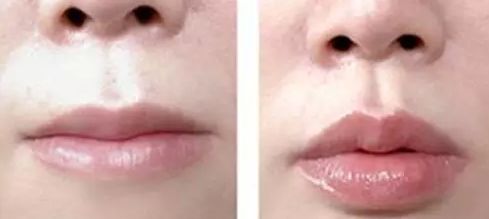 2023成都超高頻激光去雀斑權(quán)威專家評分前10強(肖凌、蒙坤容、李蕓去的人多且價格優(yōu)惠)