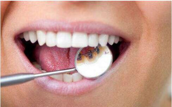 2023長沙下巴后縮正畸醫(yī)生TOP10強口碑排行(寧勝、嚴友才、黃新凡評價一致贊美)