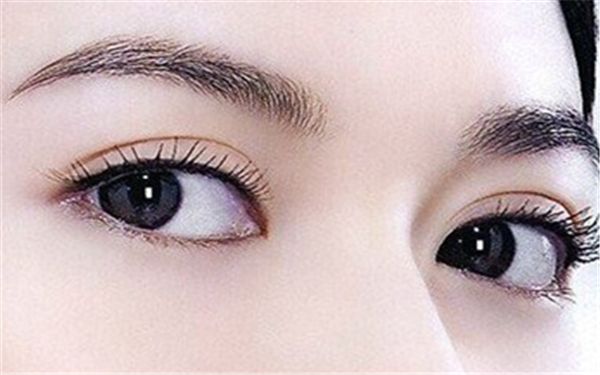 如何選擇北京雙眼皮埋線哪家好？細(xì)致評級(jí)幫您快速?zèng)Q策！