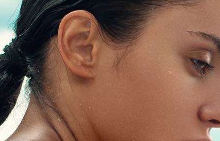 福州胎記?？漆t(yī)院哪家好？解析福州市胎記治療醫(yī)院排名