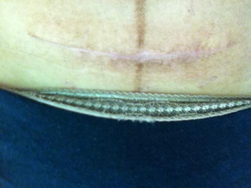 2023深圳切口拉皮正規(guī)醫(yī)生評(píng)分(范明明、黃丹丹、張干林強(qiáng)勢(shì)推薦~)