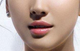 2023南京黃褐斑評(píng)分10強(qiáng)醫(yī)生(張東、梁月琴、徐勁松技術(shù)穩(wěn)定，審美在線，不踩坑！)