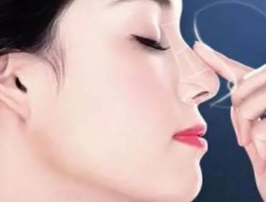 上海激光祛斑手術(shù)哪家好，選擇專業(yè)激光美容醫(yī)院聰明之選