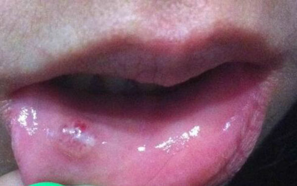 2023貴陽推顴骨專家前十上榜名單(楊倩倩、張玲、童大潮市民甄選~)