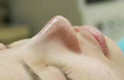 南京抽脂瘦身哪家醫(yī)院好？選對(duì)醫(yī)院是明智之舉！