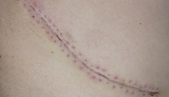 杭州整形醫(yī)院哪家服務(wù)好？選擇杭州整形醫(yī)院前需了解的幾點(diǎn)關(guān)鍵因素