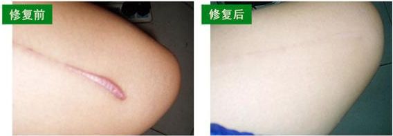 新鄉(xiāng)市眼袋手術(shù)哪家好？選擇新鄉(xiāng)市口碑最佳的眼袋手術(shù)醫(yī)院