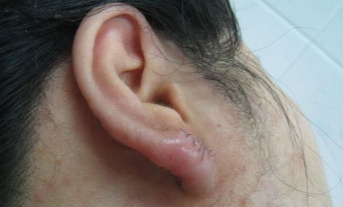 南京下頜骨整形醫(yī)院排名及口碑如何？