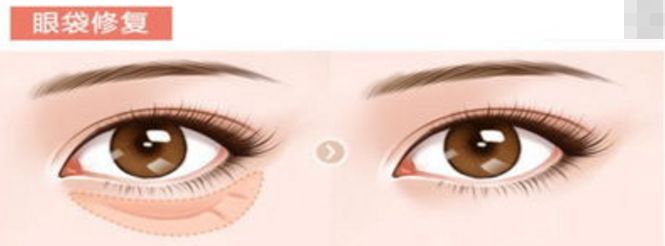 上海自體豐面部醫(yī)院排名榜單及評價對比[詳細(xì)分析]