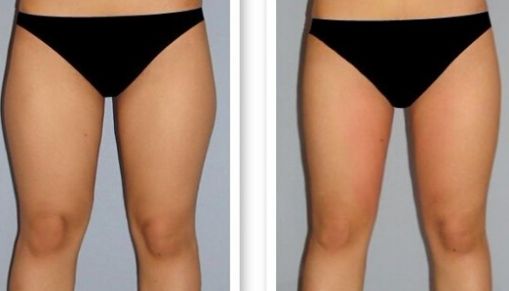 長沙哪家激光點(diǎn)痣醫(yī)院口碑好？