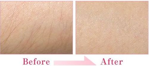 廣東珠海科美醫(yī)療美容醫(yī)院怎么樣？廣東珠海科美醫(yī)療美容醫(yī)院簡介|醫(yī)生團(tuán)隊|口碑評價！