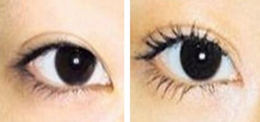 寧波豐胸美容醫(yī)院哪家好？選擇豐胸最佳醫(yī)院，看看這些指標！