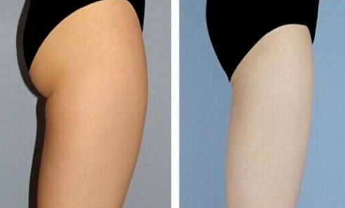 上海改臉型整形哪家醫(yī)院好？專家推薦悅美人整形醫(yī)院！