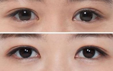 廣州整形醫(yī)院排行榜-誰知道廣州整形醫(yī)院哪家好且口碑好