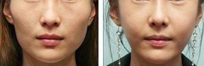 重慶雙眼皮整形醫(yī)院評價如何？哪家信譽好？