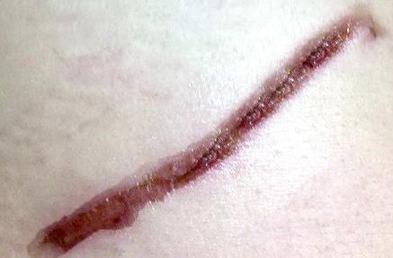 吉林市眼袋修復(fù)哪家醫(yī)院好？