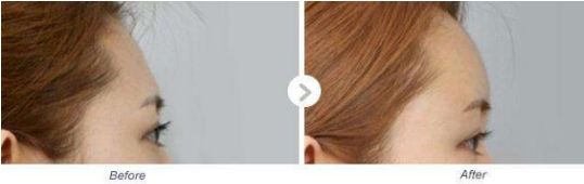 河南有哪家專業(yè)的小腿抽脂醫(yī)院值得推薦？