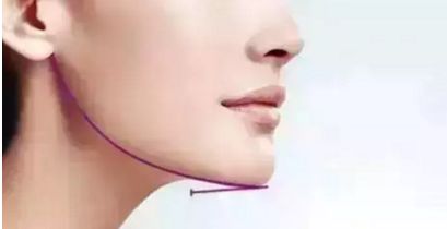 蘭州雀斑問題煩惱？快來尋找最佳治療方法，推薦多家正規(guī)醫(yī)院！