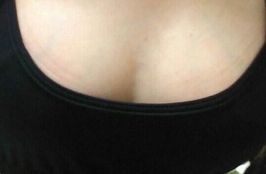 青島哪家醫(yī)院雙眼皮手術(shù)效果好，術(shù)后無后顧之憂