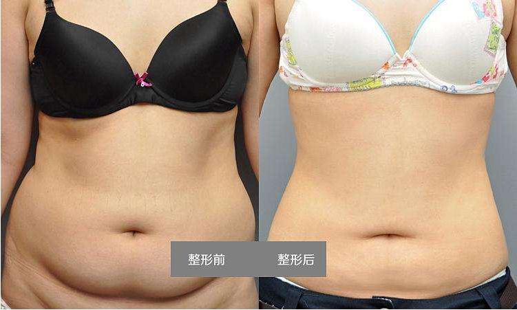 北京祛眼袋手術(shù)醫(yī)院排名前十強(qiáng)對比解析