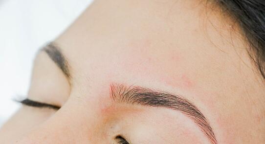 北京喬雅登名醫(yī)挖掘，新榜單首揭誰更強？技術絕優(yōu)對決揭曉！