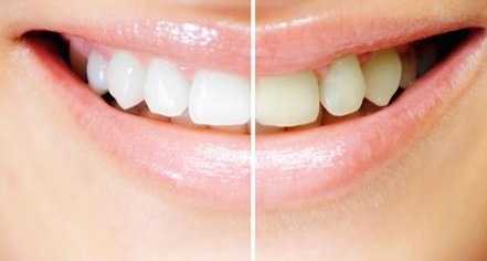 南方醫(yī)院董自清做面部脂肪填充效果如何？樸素自然且光滑無痕，沒有坑洼效應(yīng)嗎？