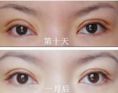 2023上海分型祛痘美膚醫(yī)生口碑榜前十位(鄒文強(qiáng)、孫文海、王君實(shí)力前三跑不脫！)