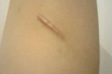 南京哪家整形醫(yī)院的整形美容效果好？