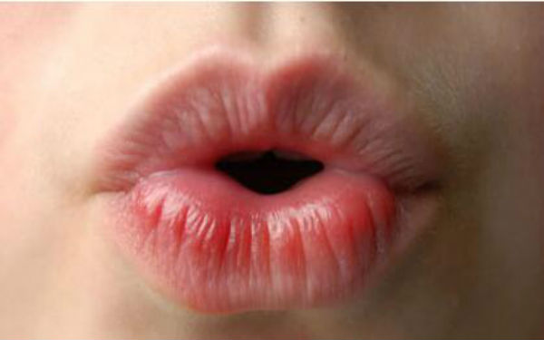 2023成都抬頭紋剝離大型醫(yī)生(董灜、周斌、劉國權(quán)當(dāng)屬當(dāng)?shù)孛麣飧?