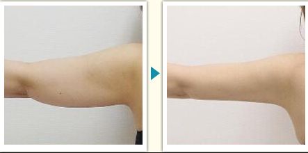 衢州市整容醫(yī)院哪家好？了解衢州市整容醫(yī)院的專(zhuān)業(yè)團(tuán)隊(duì)和先進(jìn)設(shè)備