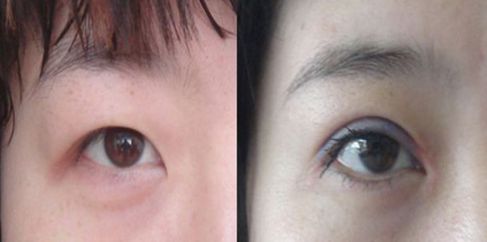 蘭州中藥祛斑哪家醫(yī)院好？解析蘭州本地祛斑療法和專業(yè)醫(yī)院推薦