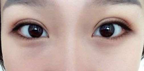 永州地區(qū)哪家正規(guī)整形醫(yī)院好？