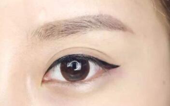 朱春艷醫(yī)師解析雙眼皮技術與手術方式，附詳細醫(yī)生介紹和診療科室信息